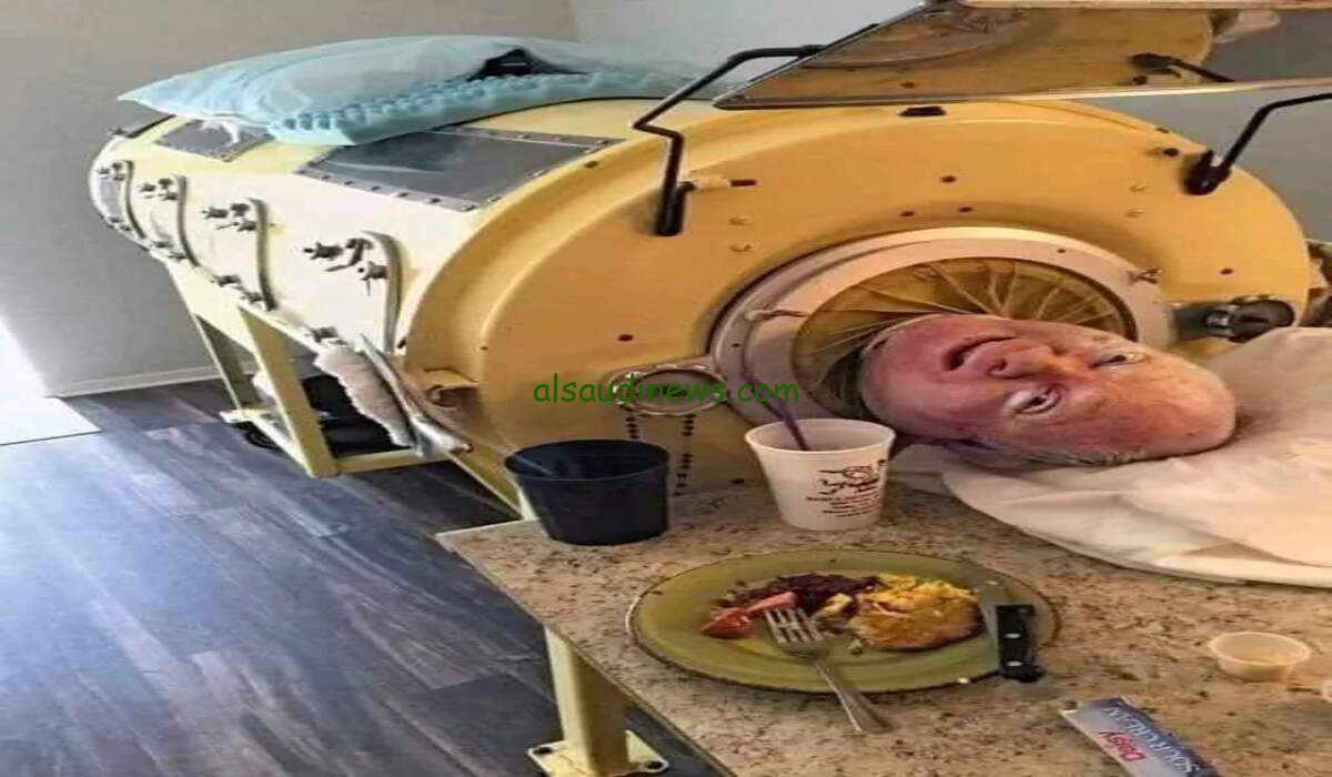 نهاية الرحلة الشاقة: وفاة رجل الرئة الحديدية بعد أن قضى فيها 70 عاما.. قصة ملهمة