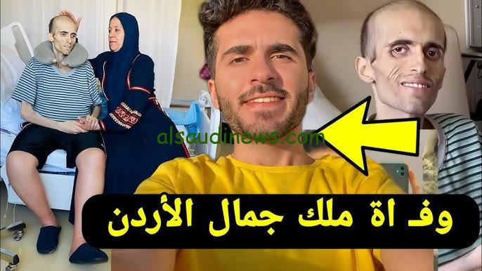 حقيقة وفاة ملك جمال الأردن | وأول رد من الأطباء علي صراعه مع السرطان