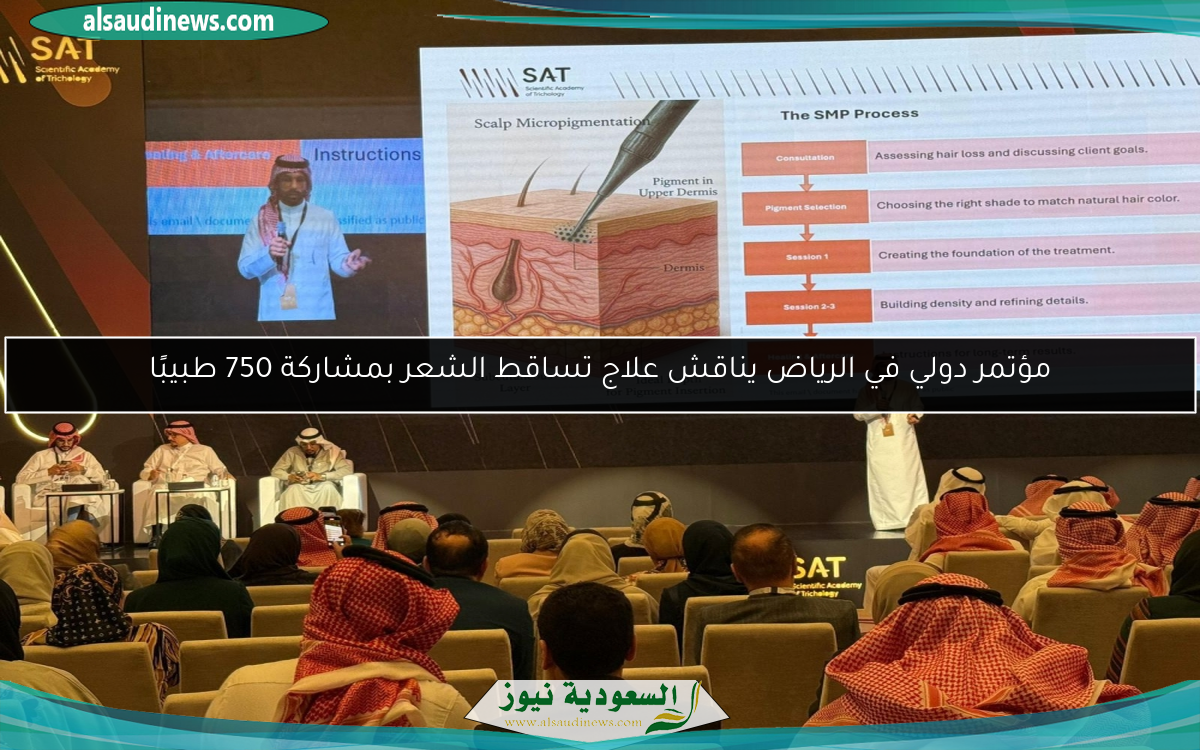 مؤتمر دولي في الرياض يناقش علاج تساقط الشعر بمشاركة 750 طبيبًا