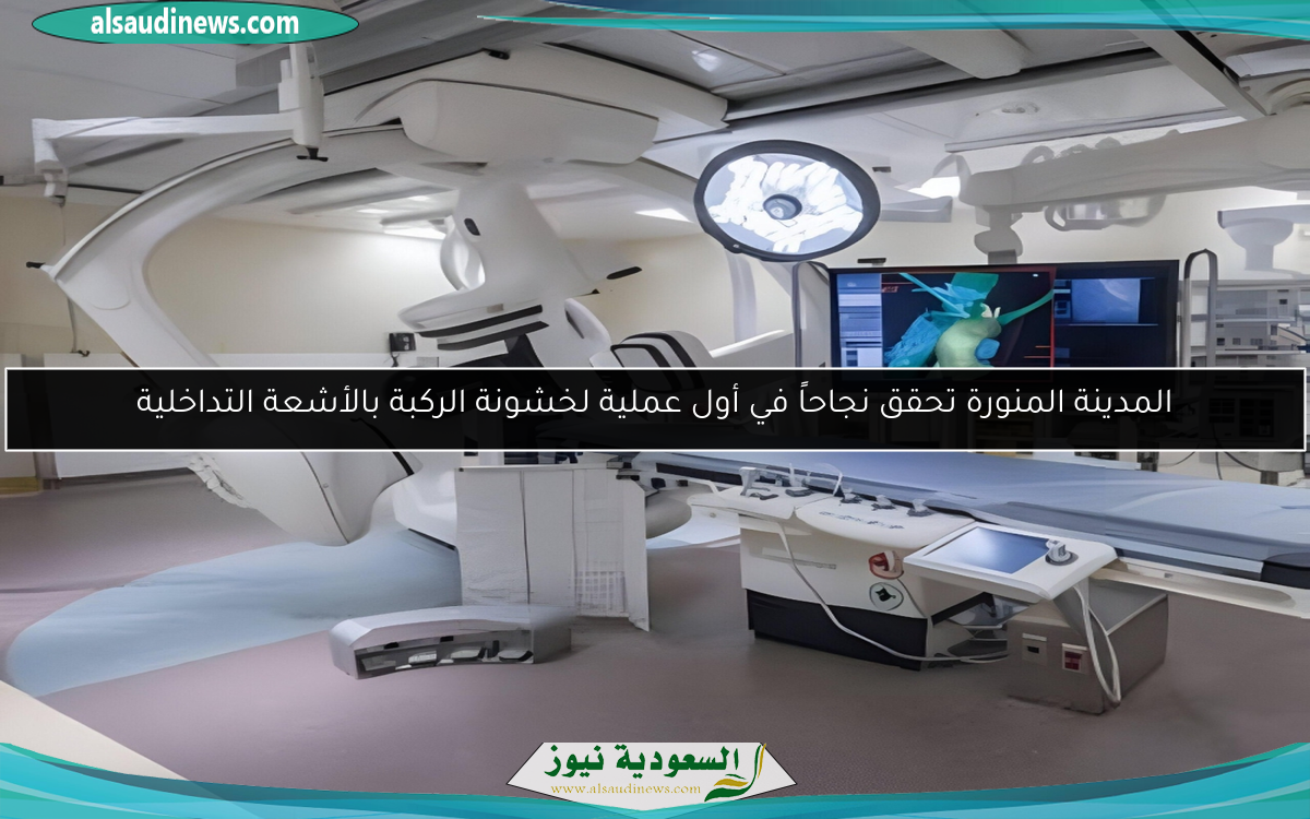 المدينة المنورة تحقق نجاحاً في أول عملية لخشونة الركبة بالأشعة التداخلية