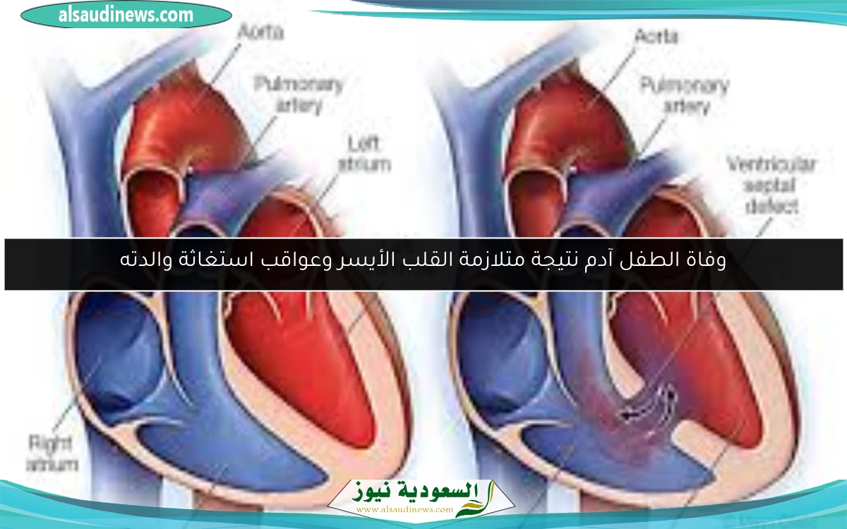 وفاة الطفل آدم نتيجة متلازمة القلب الأيسر وعواقب استغاثة والدته