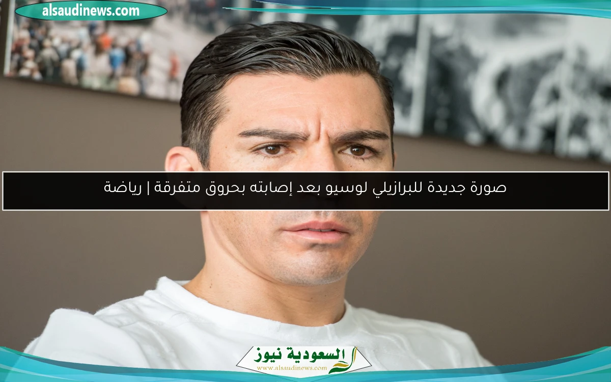 صورة جديدة للبرازيلي لوسيو بعد إصابته بحروق متفرقة | رياضة